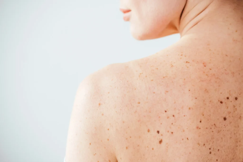 Dermatologie Dokter Klaartje Kennes